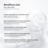 Système de Micro-Infusion™ – Sérum Anti-Acné Avancé