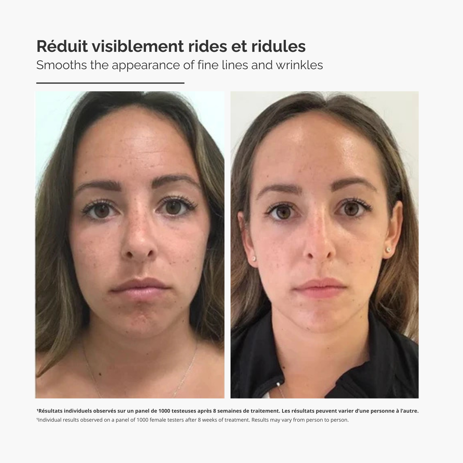 Système de Micro-Infusion™ – Sérum Anti-Rides Avancé
