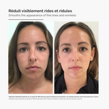 Système de Micro-Infusion™ – Sérum Anti-Rides Avancé